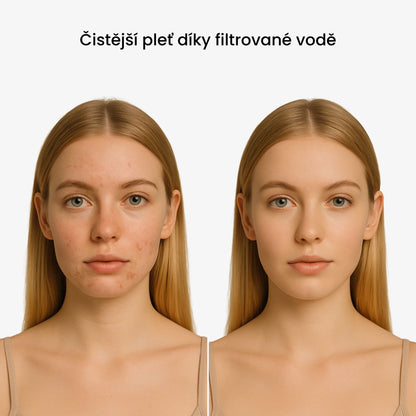 DermaLabs – Sprchová hlavice pro zdravější vlasy a pokožku